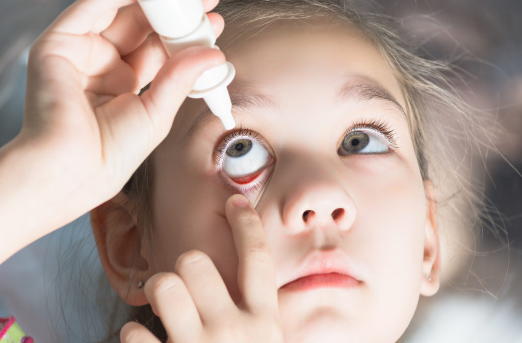 Young child putting eye drops into her eyes to help control myopia from progressing