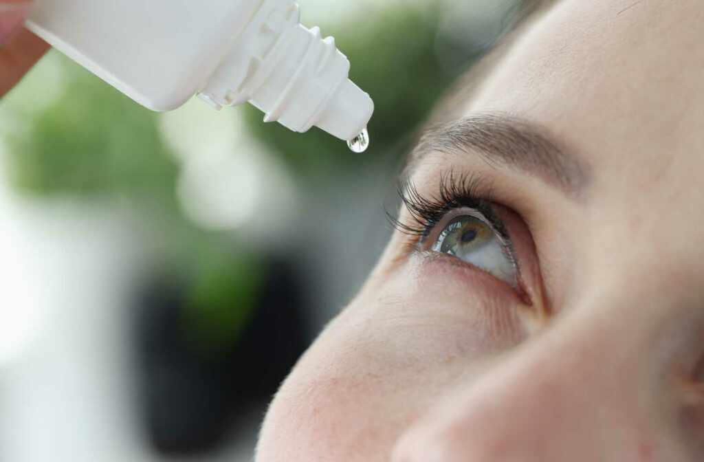 A woman adds an eye drop to her eye.